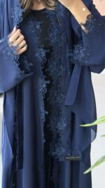 ⁦V11⁩ - الصورة ⁦5⁩